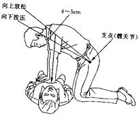 应急救护知识--心肺复苏术